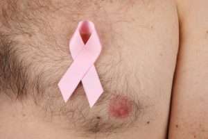 Brustkrebs ist auch Männersache!